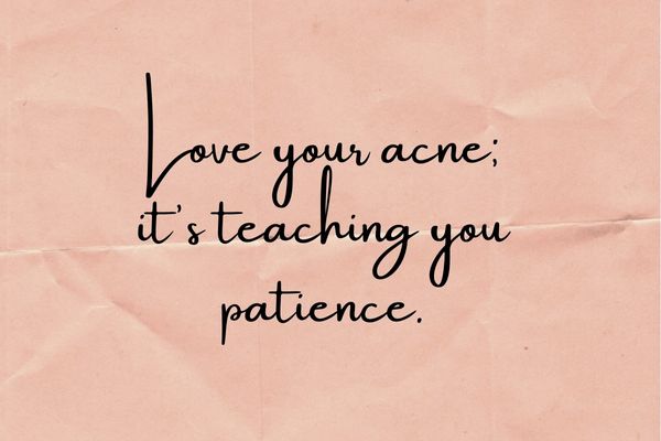Love your acne it's teaching you patience.